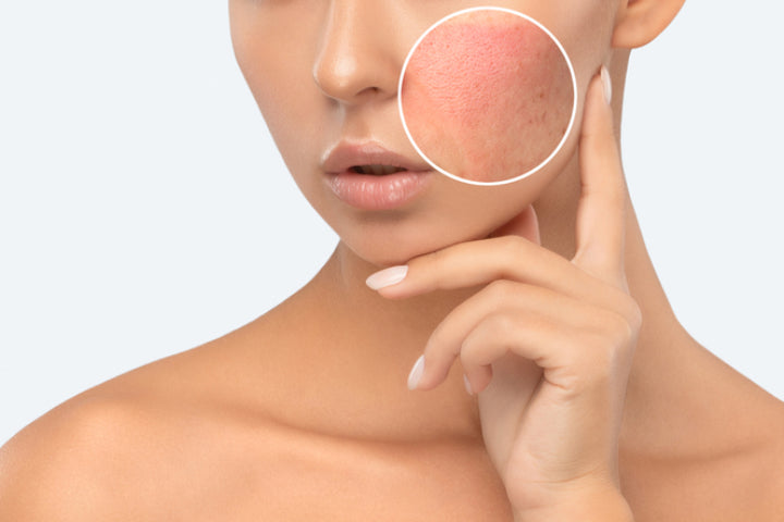 What Those Bumps on Your Skin Mean