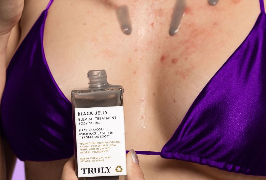 How to Get Rid of Boob Acne: Causes, Treatments, & Top-Rated Products
