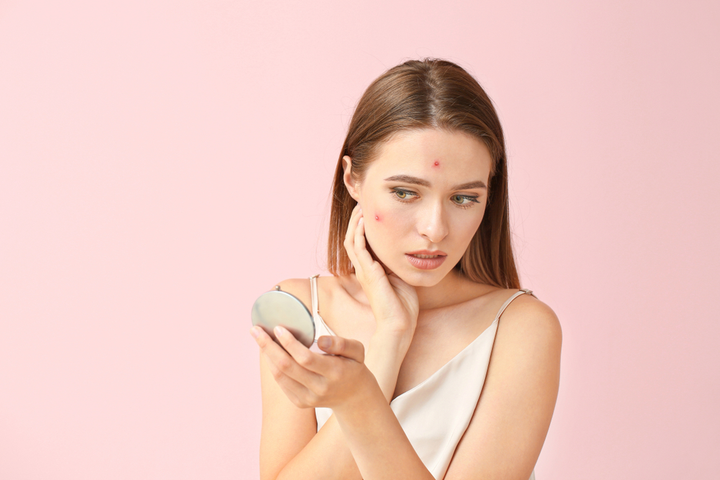 Why Am I Getting Zits… As an Adult?