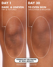 Side-by-side comparison of a knee on day 1 (dark, uneven, dry) and day 30 (brighter, smoother skin) shows visible improvement in hyperpigmentation after 30 days using Truly Beauty Jelly Booster Pigment Body Potion.