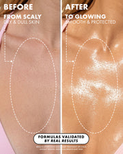 Before and after comparison of skin treatment on a person's shoulder, showing scaly, dry, and dull skin to smooth and protected skin.