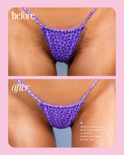 Two close-up photos of a bikini line in purple floral underwear show the “before” with visible pubic hair and texture, and the “after” with smoother, hydrated skin and fewer ingrown hairs after using Truly Beautys Cooka Oil. Text highlights its benefits.