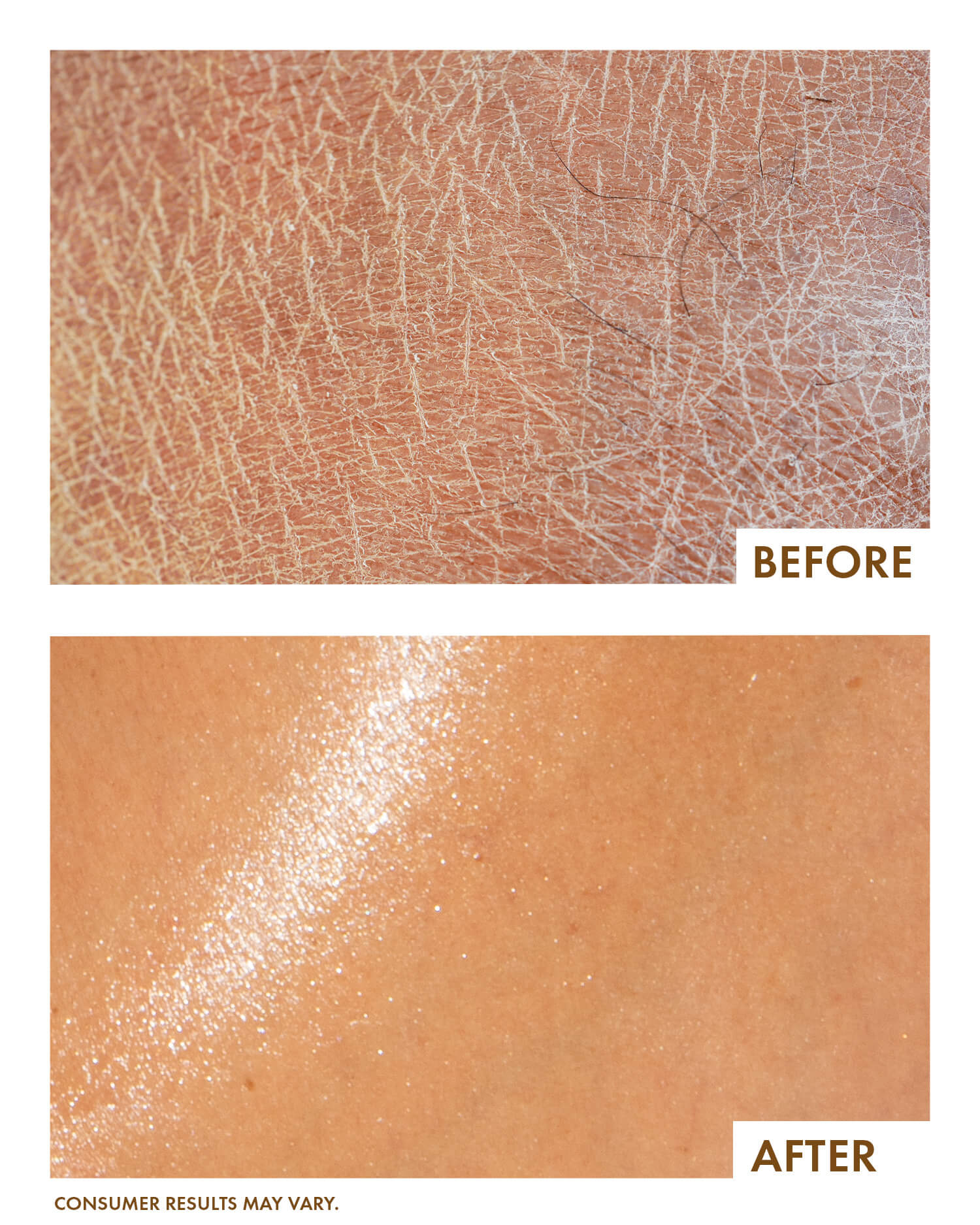 Before and after comparison of skin texture with 'Before' showing rough texture and 'After' showing smoother texture.
