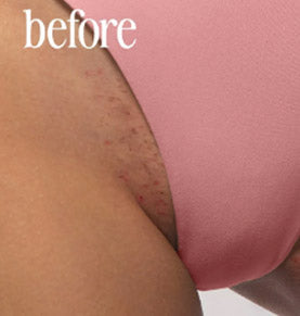 Before Skin Care