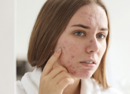 3 Signs You're Allergic To Your Skincare Products