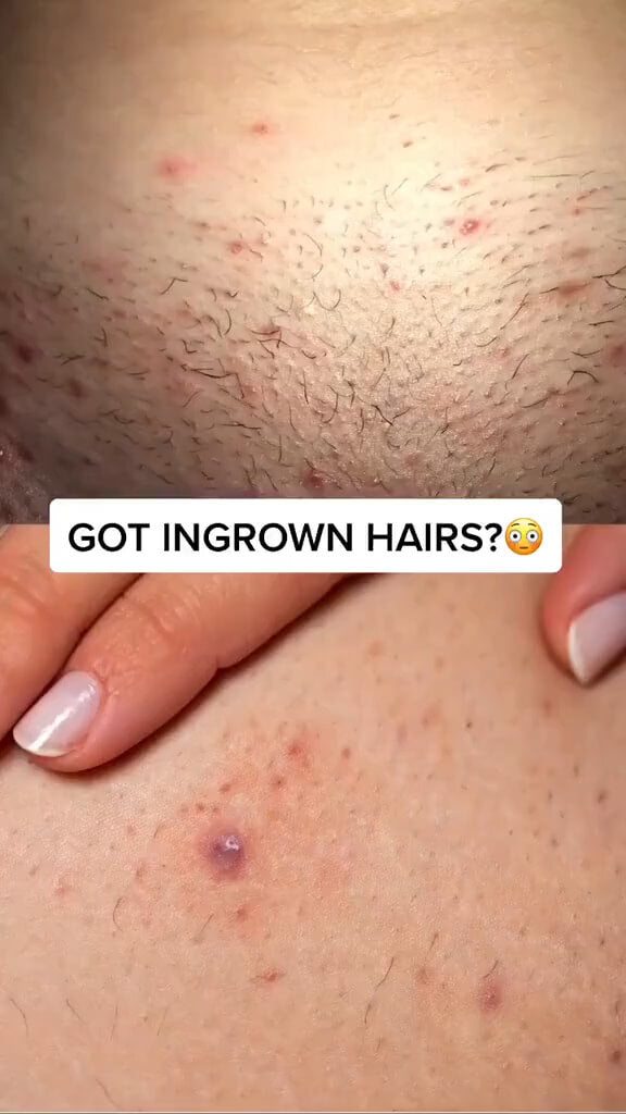 Jelly Booster