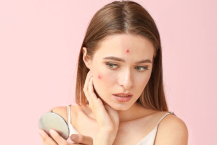 young woman with pimples looking at complexion in small mirror