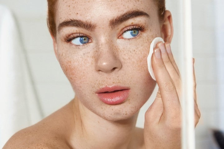 4 Types of Acne + How to Treat Them