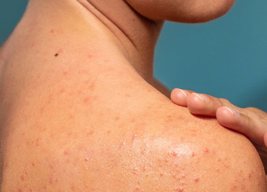 kate middleton skincare routine | kate middleton closeup photo