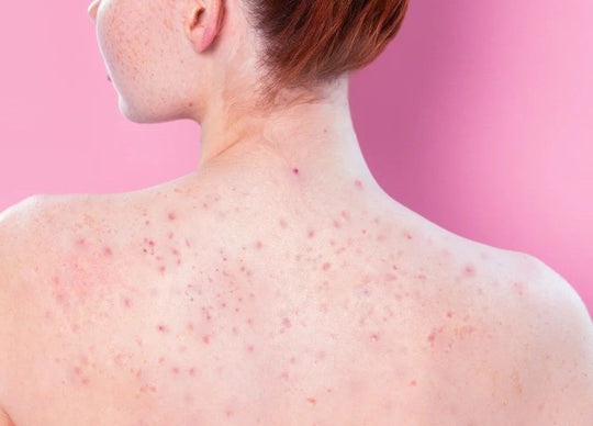 how to get rid of cellulite on arms | side by side image showing young woman in pilates class holding bottle of Truly's the firming body serum beside close up image of The firming serum