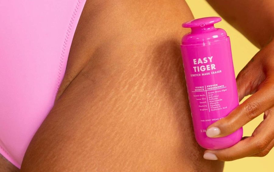 do stretch mark creams work | Person applying a pink bottle labeled 'Easy Tiger' to their skin.