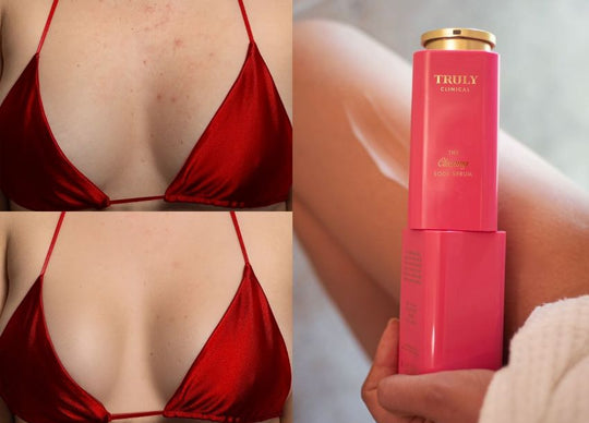 how to fix fake tan mistakes | side by side images showing closeup of Truly's Sun Drops Bronze Body Glow in glass bottle next to person's upper body wearing black strapless top with visible tan