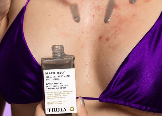 Cómo eliminar el acné en los senos: causas, tratamientos y productos recomendados