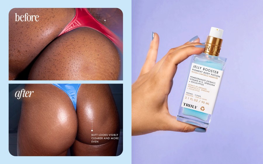 how to get rid of butt acne scars | Side-by-side comparison shows the Truly Jelly Booster Pigment Body Potion next to 
