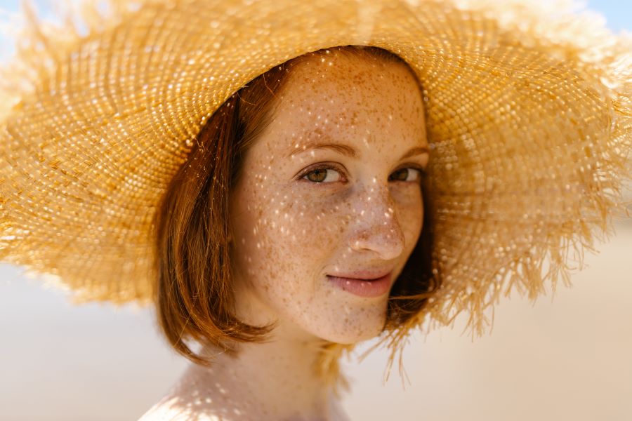 How to Get Rid of Dark Spots on Face
