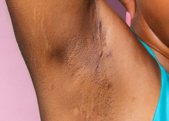 glycolic acid for armpits | side by side photos showing bottle of Truly's Smooth Legend After Shave Serum with white background and closeup of woman's bright, even underarm