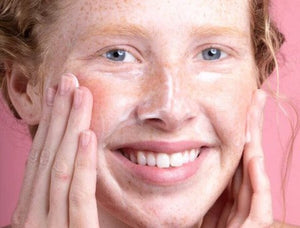 Is Hyaluronic Acid Good for Acne?