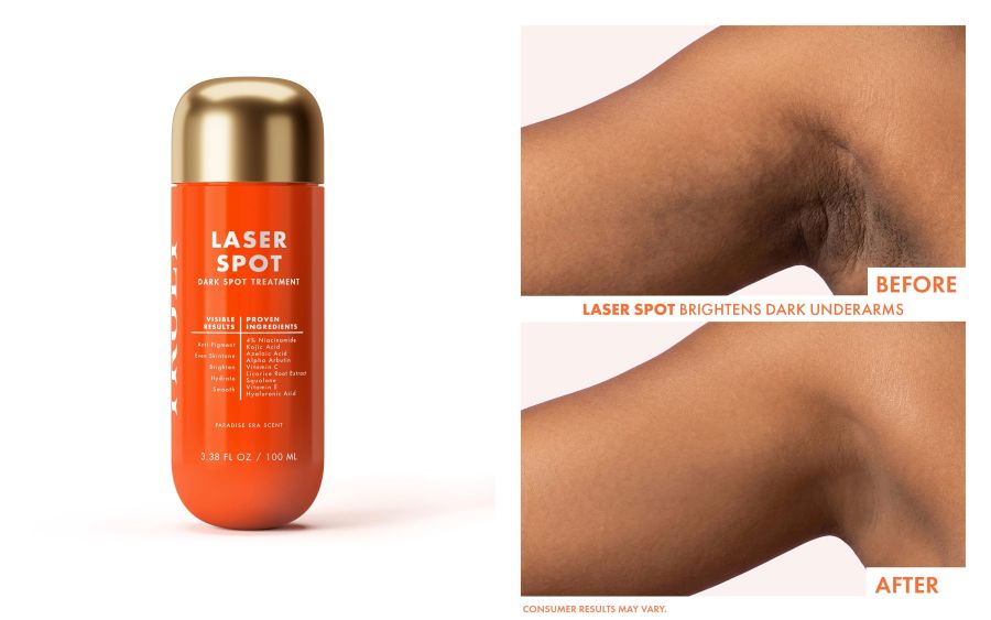 An orange bottle of Truly Laser Spot dark spot treatment with kojic acid is displayed alongside a before-and-after comparison showing brightened, more even skin tone under a person's arm.