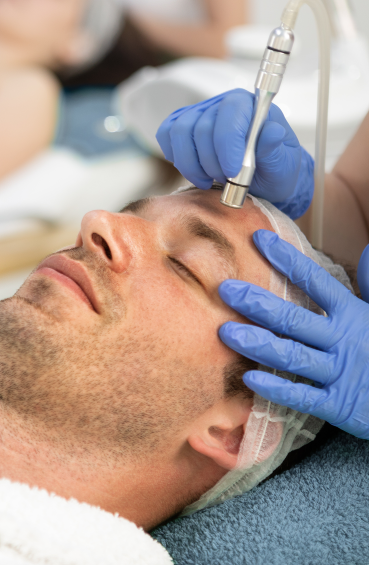 Microdermabrasion facial - What You Need to Know