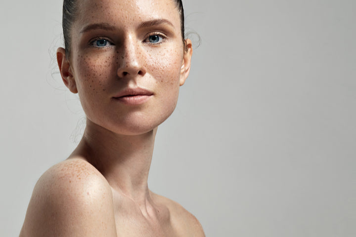 7 Derm-Approved Ways to Make Pigmentation Go Away