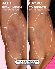 Before-and-after comparison of an underarm showing skin improvement over time, labeled 'DAY 1 FROM UNEVEN WITH DARK SPOTS' and 'DAY 30 TO BRIGHTER EVEN & REJUVENATED'.
