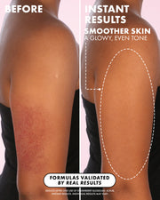 Before-and-after split-screen comparison of a person's upper back and shoulder, showing red bumpy skin on the left and smoother, clearer skin on the right, with promotional text about instant results and smoother skin.