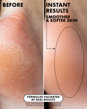 Before-and-after comparison of dry, cracked skin on a hand labeled 'BEFORE' and smooth, hydrated skin labeled 'INSTANT RESULTS SMOOTHER & SOFTER SKIN'.