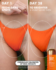 Before and after comparison of a bikini line showing a reduction in dark spots and stretch marks after 28 days of treatment with Truly Beauty Ultimate Body Sculpting Kit, featuring a jar of dark spot corrector cream at the bottom.