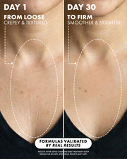 Side-by-side comparison of a neck: left (Day 1) shows loose, crepey skin; right (Day 30) shows firmer, smoother skin. Diamond Baby Treatment Body Serum by Truly Beauty reduces wrinkles with results backed by real user tests.