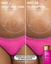Before and after comparison of a stomach showing the reduction of stretch marks and cellulite after 28 days of using a pink bottle of Truly Beauty Ultimate Body Sculpting Kit.