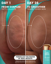 Before and after comparison of hip skin texture showing a reduction in cellulite dimpling after 28 days of using Truly Beauty Ultimate Body Sculpting Kit, pictured next to the product bottle.