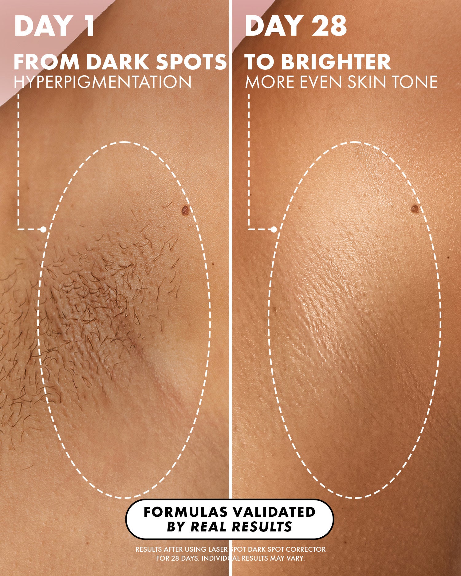 美容液 IMPREA WHITENING LASER SHOT 30mL Laser Spot Dark Spot Serum With 4% Niacinamide