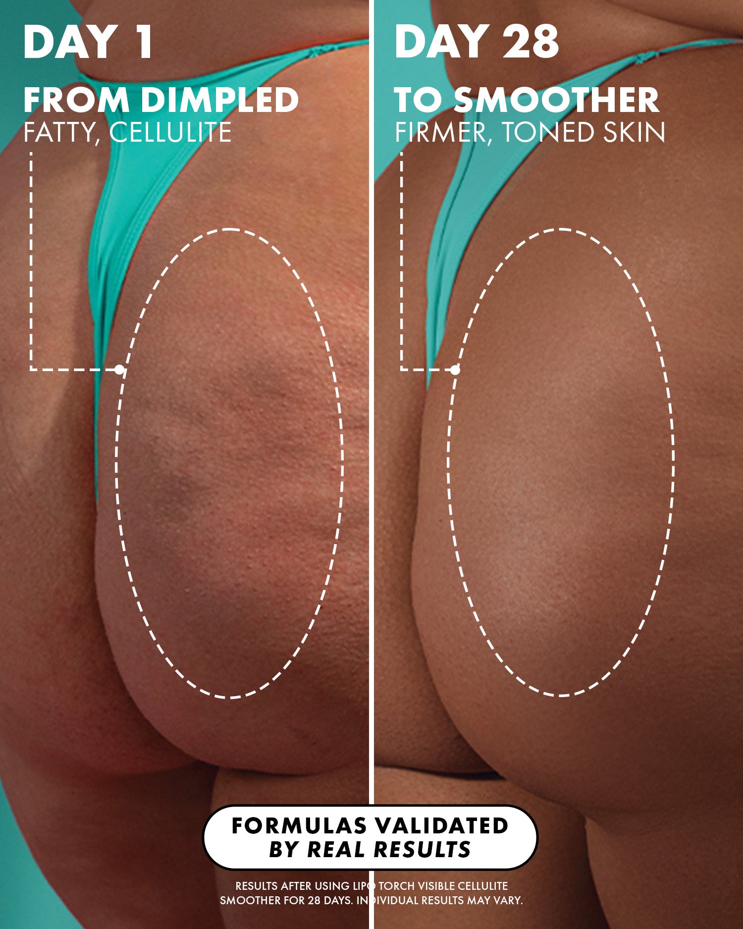 Before and after comparison of skin texture on buttocks with text indicating results from Day 1 to Day 28.