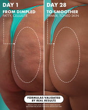 Before and after comparison of skin texture on buttocks with text indicating results from Day 1 to Day 28.