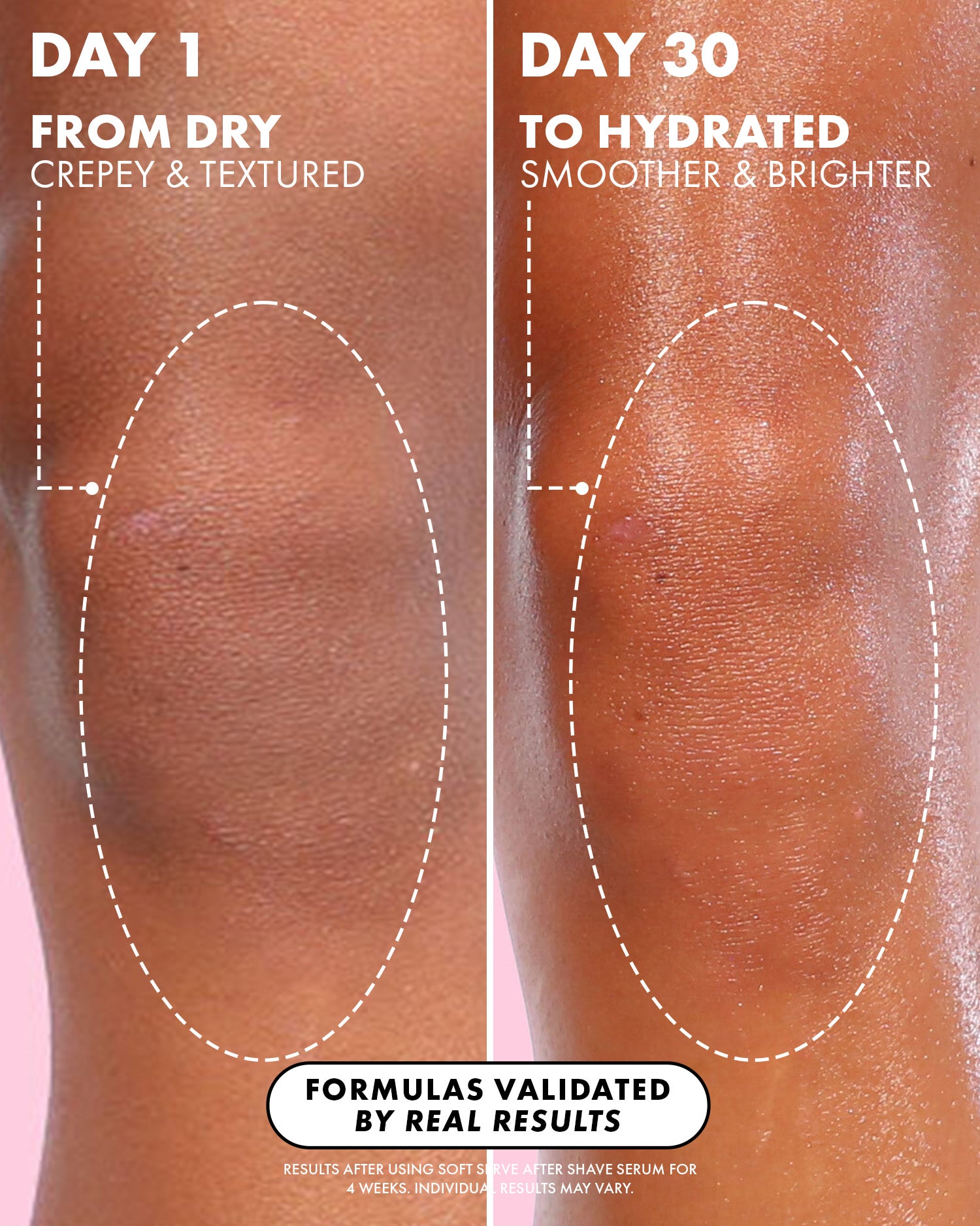 Close-up comparison: Day 1 shows dry, textured skin; Day 30 after using Truly Beauty’s Soft Serve After Shave Oil reveals smoother, brighter, and more hydrated skin. Visible results after 4 weeks of serum.