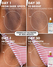 A four-panel before-and-after comparison graphic for a skincare serum, showing close-up skin results labeled Day 1 and Day 30 for dark spots, tone, and dryness/smoothness. A small bottle of the serum is shown in the top-right and bottom-right panels, with text reading 'Formulas validated by real results.