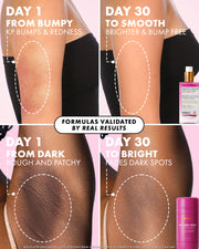 Split image shows The Viral Edit by Truly Beauty: top row reveals fewer bumps and less redness in 30 days; bottom row highlights glycolic acid and niacinamide fading dark spots for a brighter tone. Serum bottle featured.