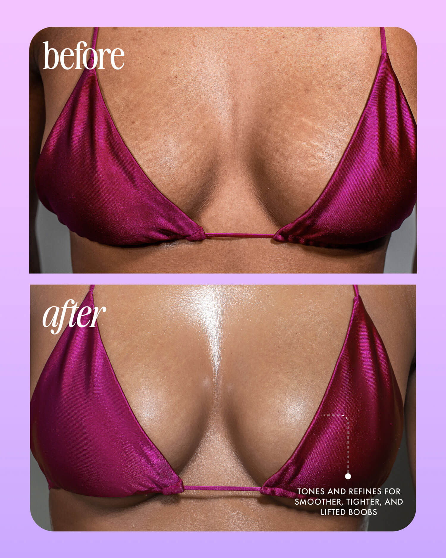 Acai Your Boobies Firming Body Serum