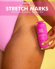 A person in a pink swimsuit applies Truly Beauty’s Easy Tiger Stretch Mark Eraser E-Book tips to their upper thigh with visible stretch marks. The text reads: “The Ultimate Guide to Stretch Marks—Rituals for Smoother, Radiant Skin.”.