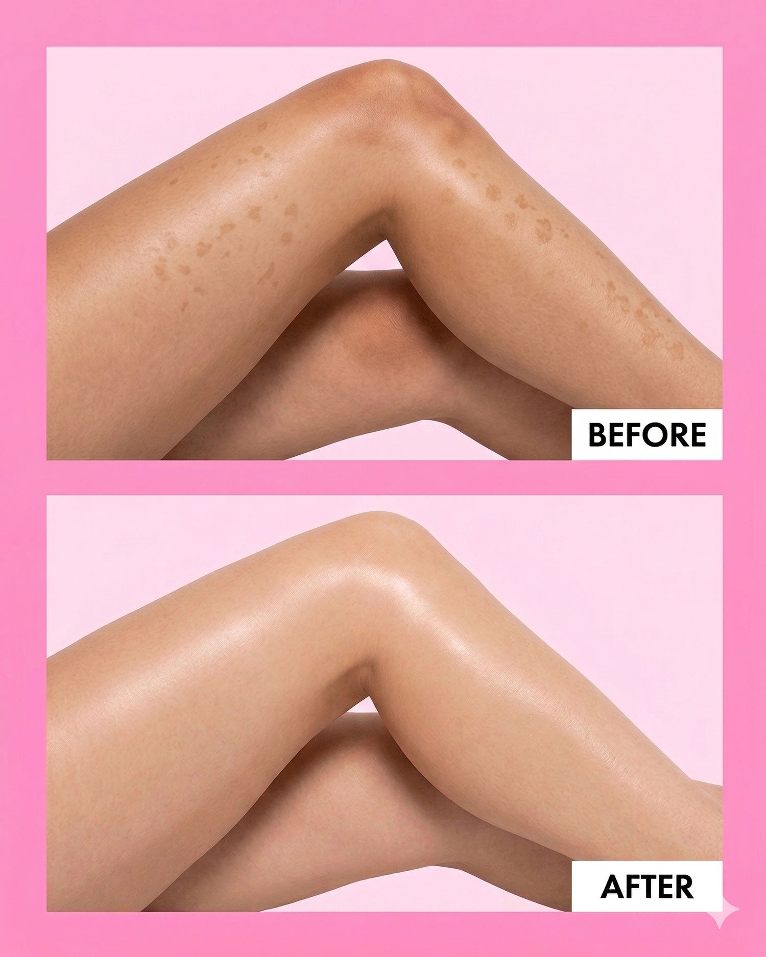 Before and after smooth skin results by Trisha