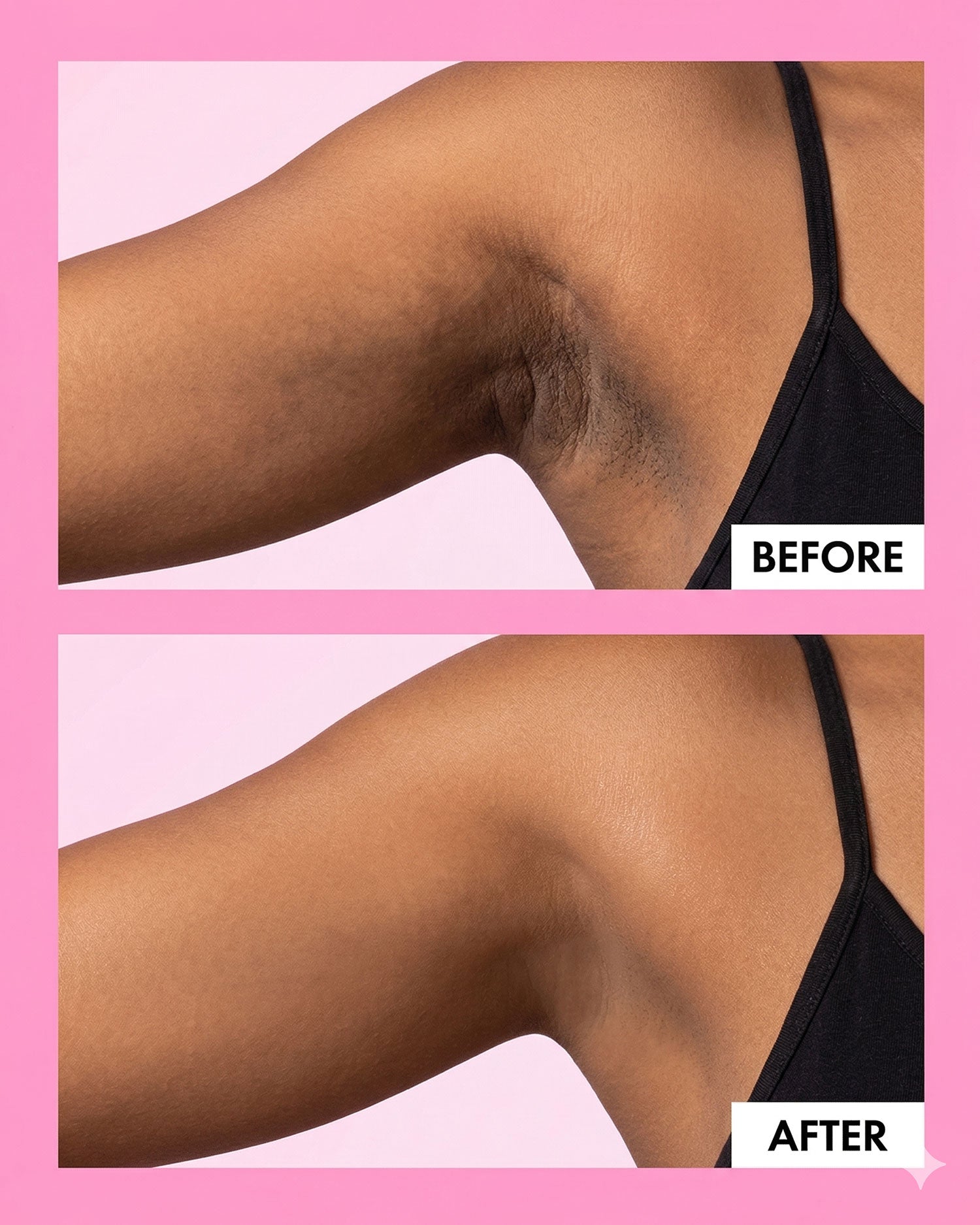 Before and after smooth skin results by Trisha