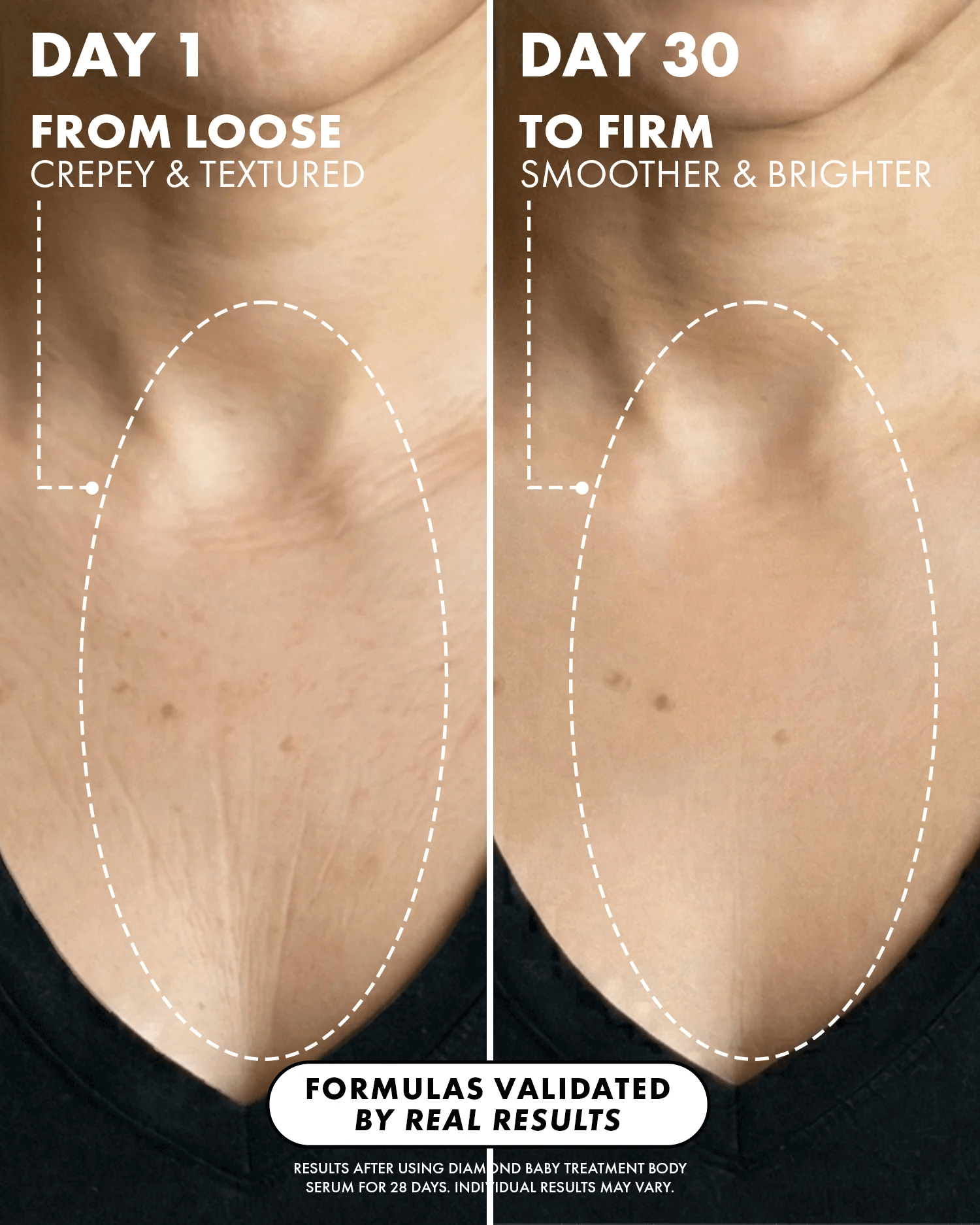 Before and after smooth skin results by Trisha